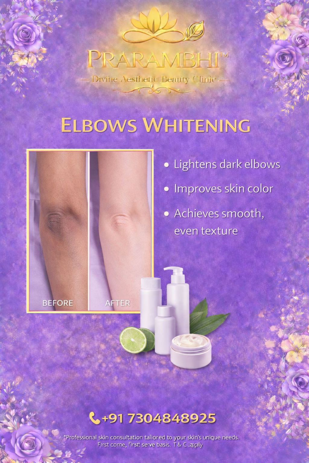 elbow whitening treatment