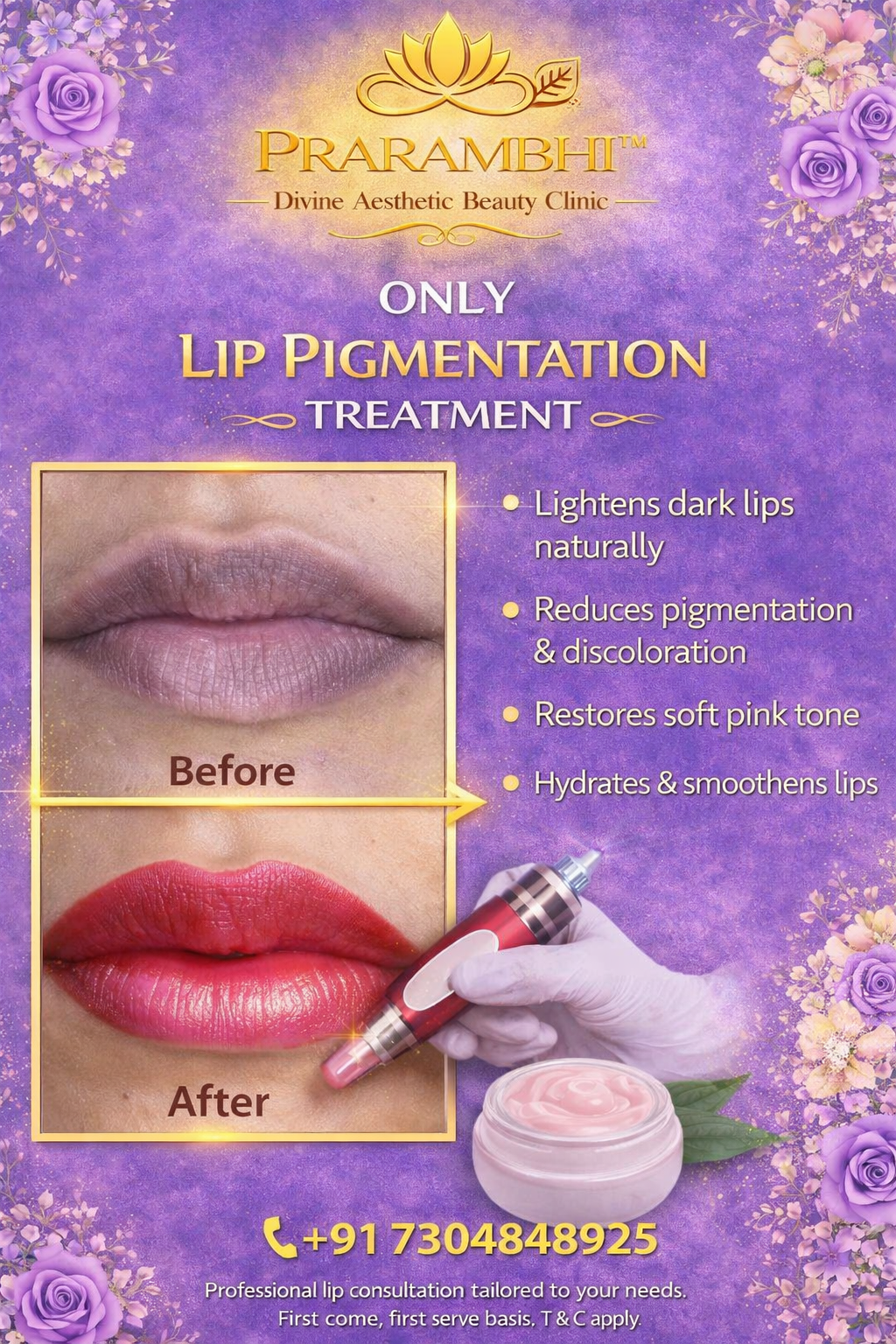 Lip Pigmentation Treatment