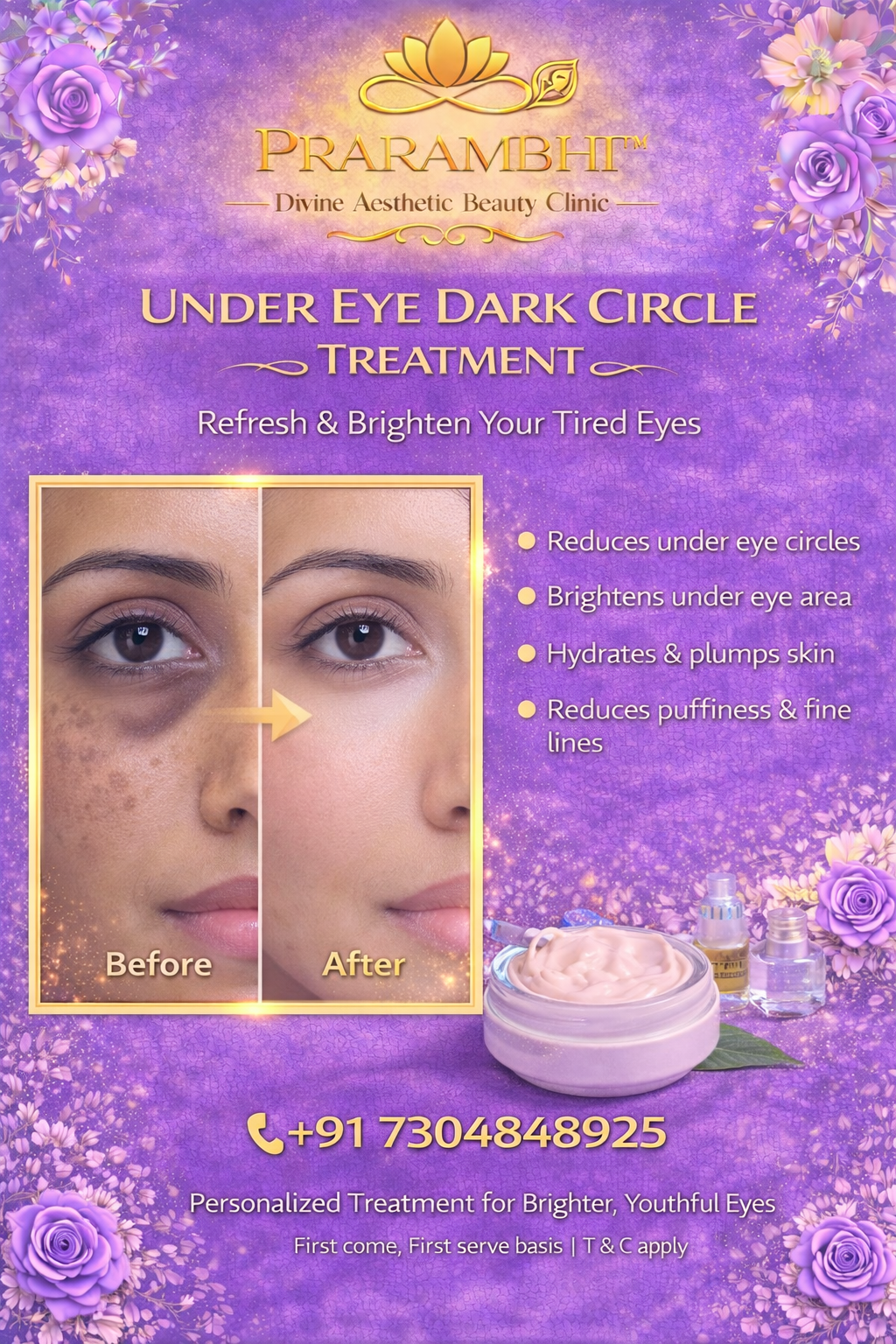 Under Eye Dark Circle Treatment
